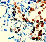 PAB12655 - Androgen receptor
