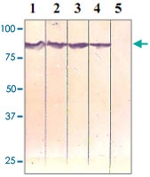 PAB12658 - Catenin beta-1
