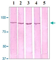 PAB12659 - Catenin beta-1