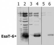 PAB1266 - ESAT6