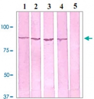 PAB12660 - Catenin beta-1