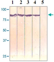 PAB12661 - Catenin beta-1