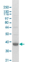 PAB12666 - CD20