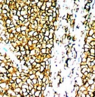 PAB12666 - CD20