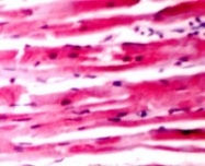 PAB12677 - Desmin