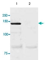 PAB12680 - NOS3