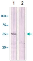 PAB12682 - Estrogen receptor beta