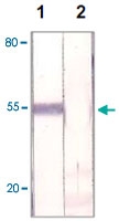 PAB12683 - FOXP1