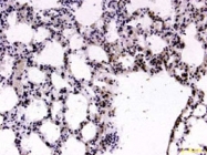 PAB12684 - FOXP2