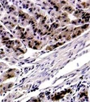PAB12686 - FOXP4 / FKHLA