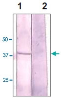 PAB12687 - GSK3 alpha