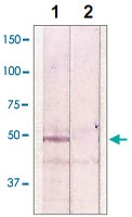 PAB12689 - GSK3 beta