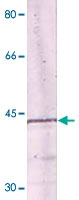 PAB12692 - NFKBIA / IKBA