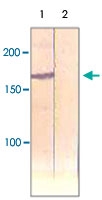 PAB12695 - IRS1