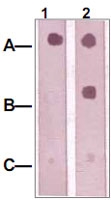 PAB12695 - IRS1