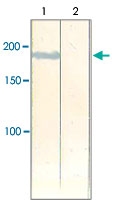PAB12697 - IRS2