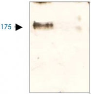 PAB12699 - LRP5