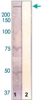 PAB12701 - PARK8 / LRRK2