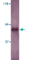 PAB12702 - LSP1 / WP34