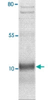 PAB12703 - SCGB2A1 / Mammaglobin B