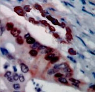 PAB12703 - SCGB2A1 / Mammaglobin B