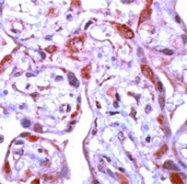 PAB12708 - MMP-1