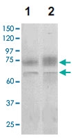 PAB12711 - MMP-2
