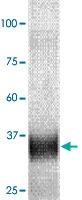 PAB12712 - MMP-7
