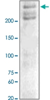 PAB12717 - Neurofibromin