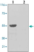PAB12719 - TP53 / p53