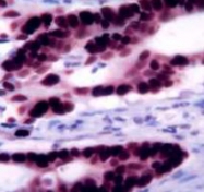 PAB12719 - TP53 / p53