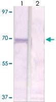 PAB12720 - RPS6KB1 / STK14A
