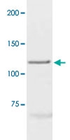 PAB12723 - Progesterone receptor