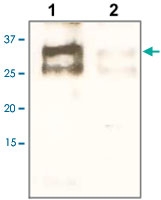 PAB12726 - EBAG9 / RCAS1
