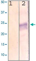 PAB12727 - Rhodopsin