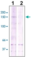 PAB12729 - ROCK2