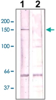 PAB12730 - ROCK2