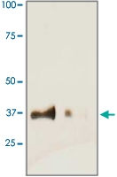 PAB12744 - Cardiac Troponin T