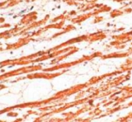 PAB12744 - Cardiac Troponin T