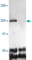 PAB12746 - CD309 / VEGFR-2 / Flk-1