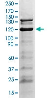 PAB12749 - Tyrosine-protein kinase JAK2