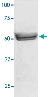 PAB12750 - LCK