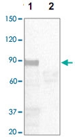 PAB12756 - STAT5 / STAT5A