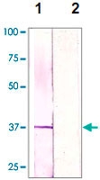 PAB12757 - CDK1