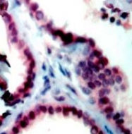 PAB12757 - CDK1