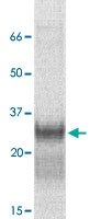 PAB12758 - CIS1