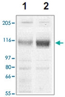 PAB12760 - CORIN
