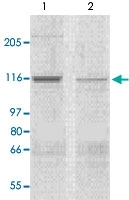 PAB12762 - CORIN