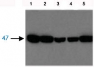 PAB12766 - Fumarylacetoacetase