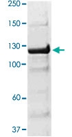 PAB12770 - Tyrosine-protein kinase JAK2
